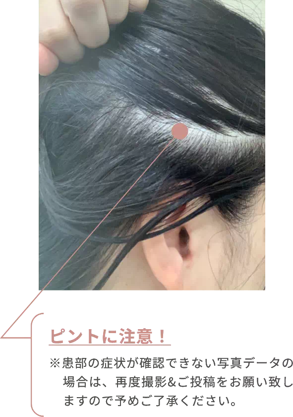 ピントに注意!※患部の症状が確認できない写真データの場合は、再度撮影&ご投稿をお願い致しますので予めご了承ください。